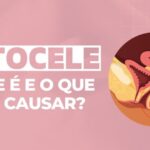 Entendendo o Síndrome Pulmão Rim: Causas e Tratamentos