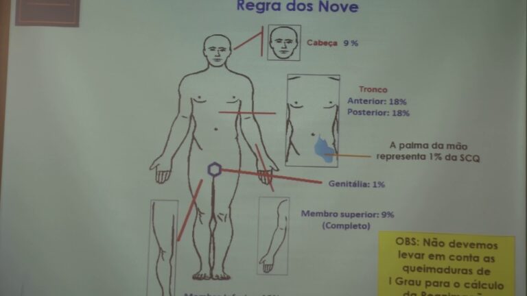 Diagrama de Lund e Browder: Guia Completo e Simplificado