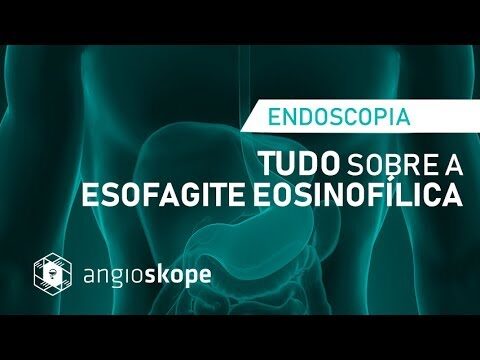 Tratamento da Esofagite Eosinofílica: Estratégias e Eficácia