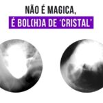 Benefícios do Citoneurim Oral: Tudo o que Você Precisa Saber