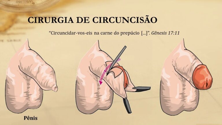 Benefícios da circuncisão masculina: o que toda pessoa circuncidada precisa saber