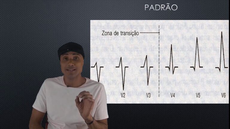 Eletro Normal: Entendendo as Ondas e Seus Efeitos