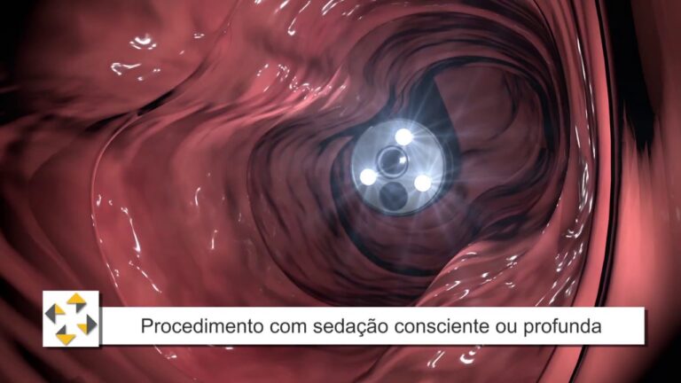 A importância da indicação de colonoscopia