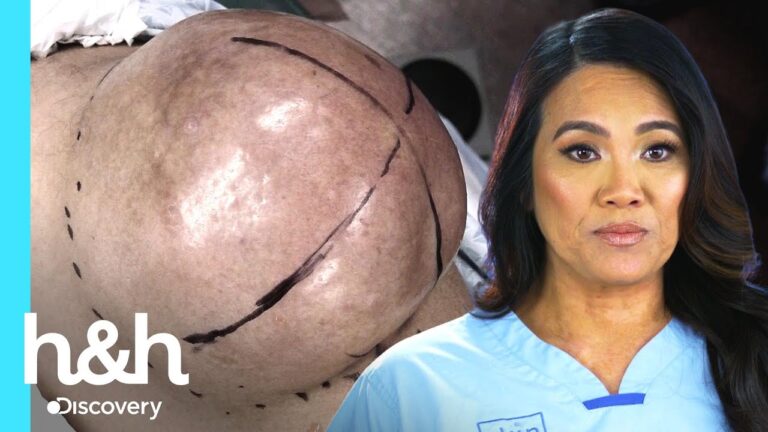 O fenômeno Escore Lee: o que você precisa saber