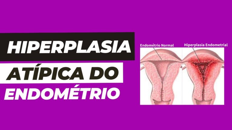 Diagnóstico da Hiperplasia Endometrial Atípica
