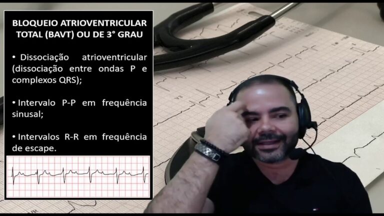 Bloqueio AV de 3º Grau: Causas, Sintomas e Tratamentos