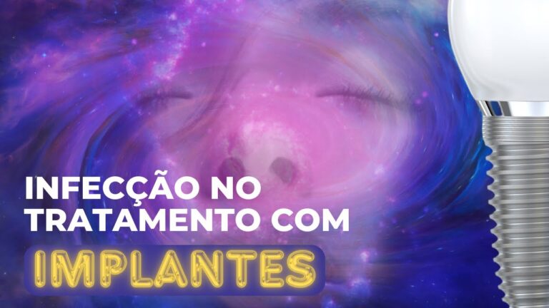 Infecção em Implantes Dentários: Causas e Prevenção