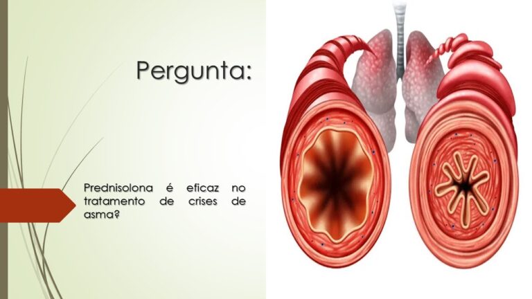 Benef&iacute;cios da prednisolona para asm&aacute;ticos