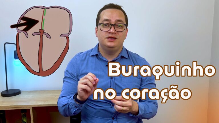 Defeito no Septo Atrial: Causas, Sintomas e Tratamentos