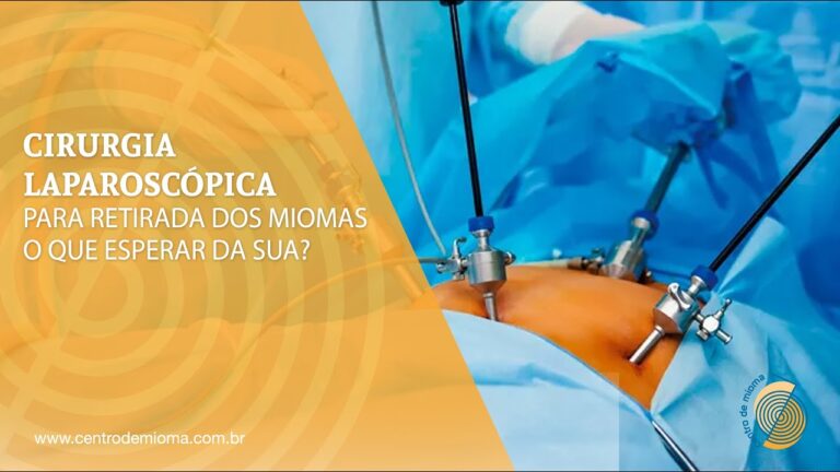 Retirada de Mioma por Videolaparoscopia: Procedimento Otimizado