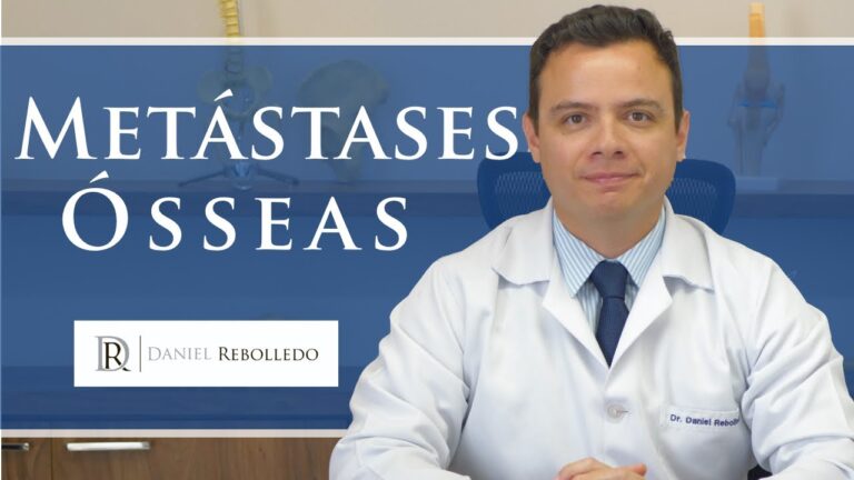 Metástase Óssea: O Que Você Precisa Saber