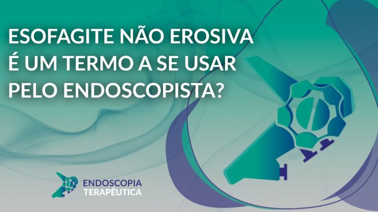 Abordagem da Esôfagite Não Erosiva: Diagnóstico e Tratamento