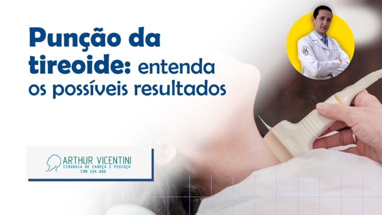 Redução do Número de Punções: Estratégias e Impacto na Prática Clínica