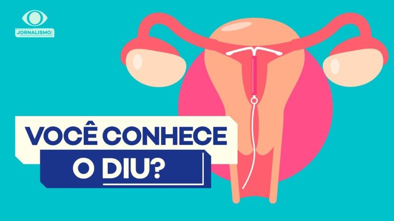 Diu: Impedindo a Fecundação de Forma Eficiente
