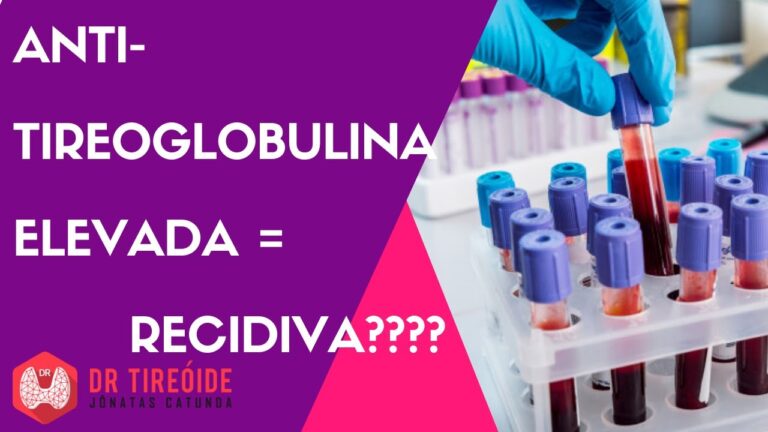 Níveis elevados de antitireoglobulina: um possível sinal de câncer