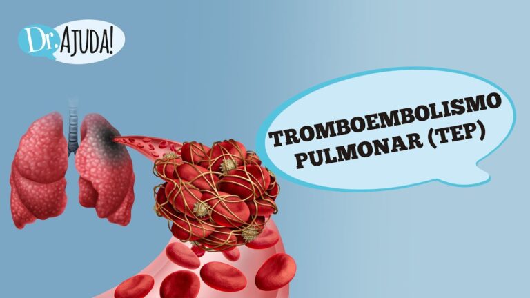 Embolectomia Pulmonar: Procedimento e Recuperação