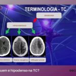 Rem&eacute;dios eficazes para ansiedade e compuls&atilde;o alimentar