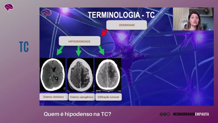 Les&otilde;es Hipodensas: Diagn&oacute;stico e Tratamento
