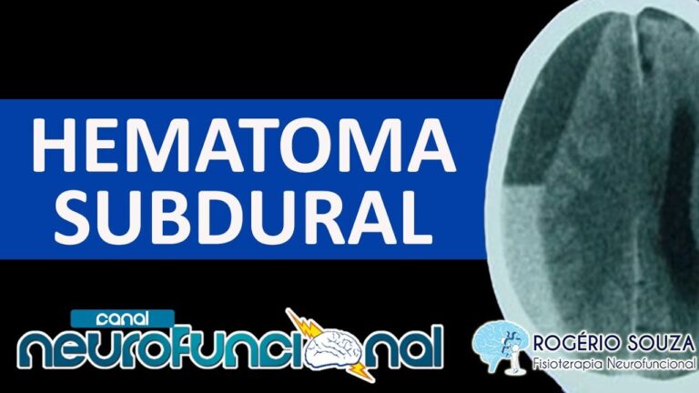 O papel dos especialistas em hematoma subdural na recupera&ccedil;&atilde;o