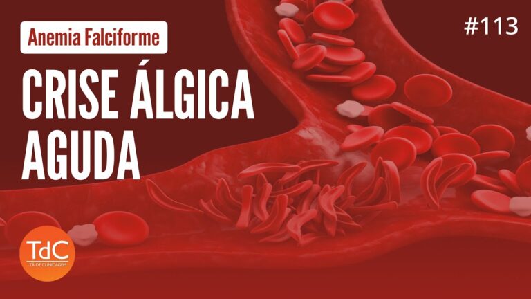 Crise &Aacute;lgica na Anemia Falciforme: Causas e Tratamentos