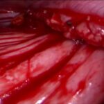 Benefícios do Citoneurim Oral: Tudo o que Você Precisa Saber