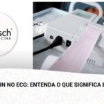 Entenda a pontada no anu: Causas e tratamentos