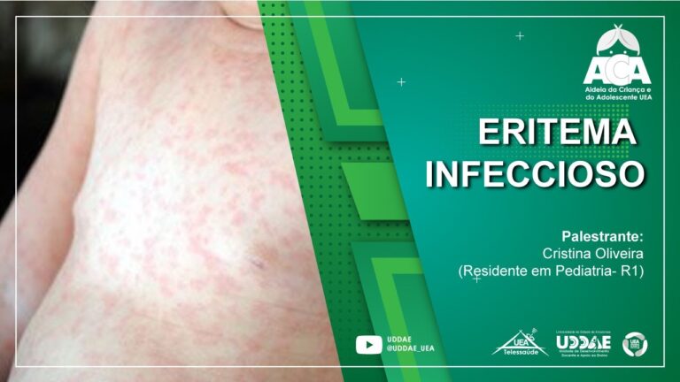 Eritema em Bebê: Causas e Cuidados Essenciais