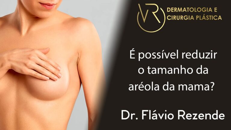 Reduzindo a Aréola Feminina de Forma Natural