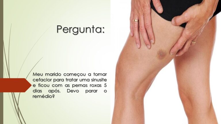 Uso de Cefaclor no Tratamento da Sinusite