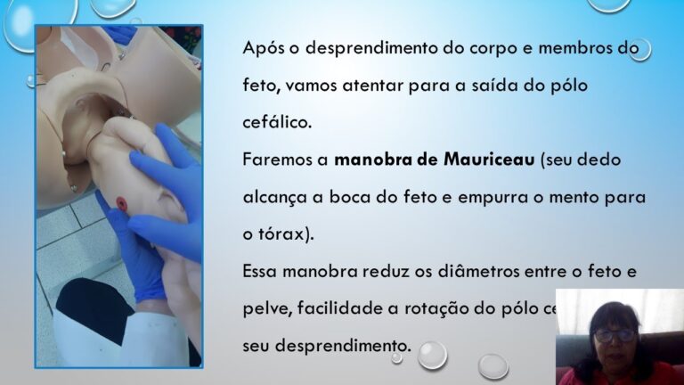 Apresentação Pélvica: Causas, Riscos e Opções de Parto