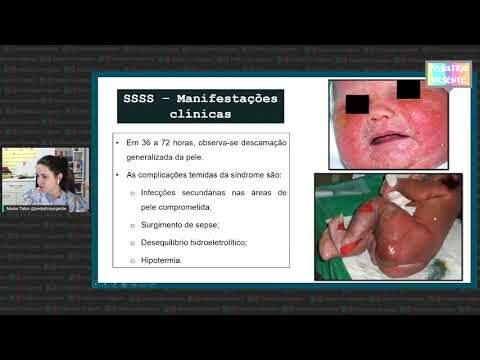 Entendendo o Síndrome da Pele Escaldada em Bebês