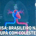 Benefícios da Máquina de Ressonância Aberta na Saúde