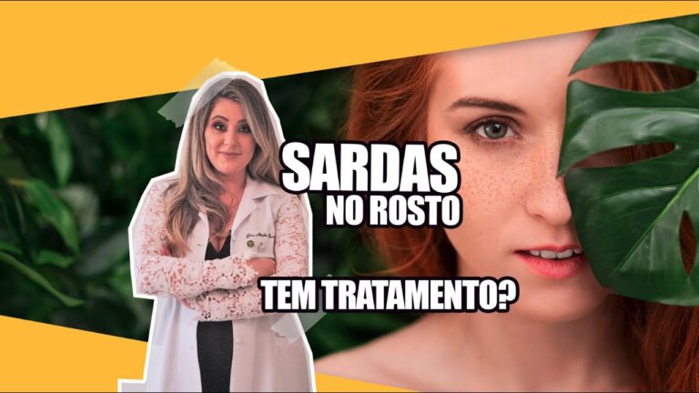 Como Clarear Ef&eacute;lides na Pele Naturalmente