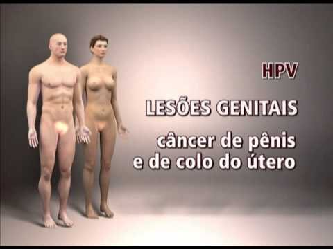 Primeiras Fotos das Verrugas do HPV