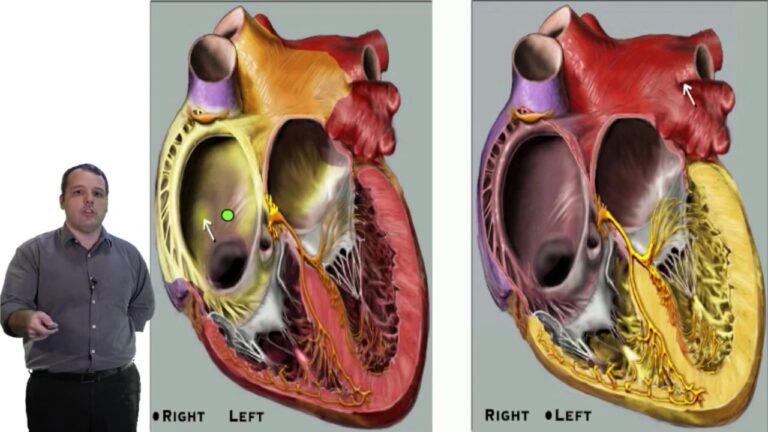Padrão de Ritmo na Taquicardia Ventricular: Regular