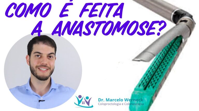 Entendendo a Anastomose Intestinal: Definição e Importância