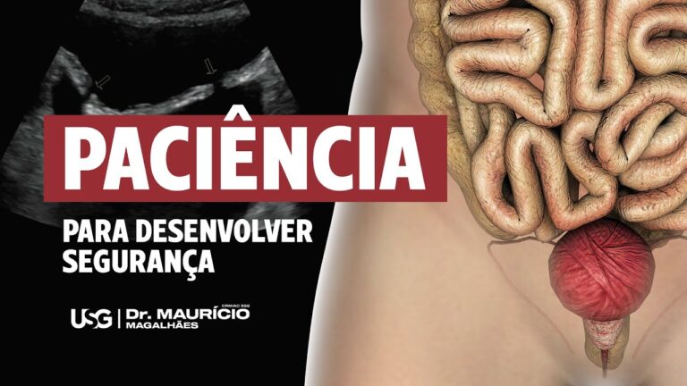 Diverticulite na Bexiga: Causas, Sintomas e Tratamentos