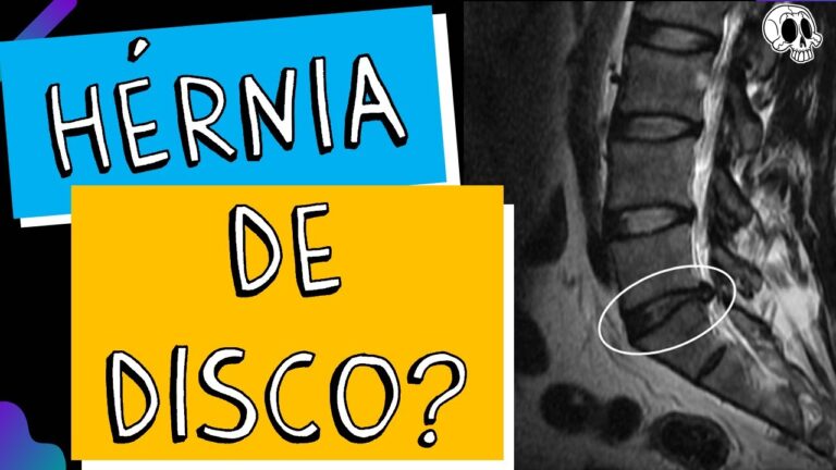 Desvendando o mistério do abaulamento craniano
