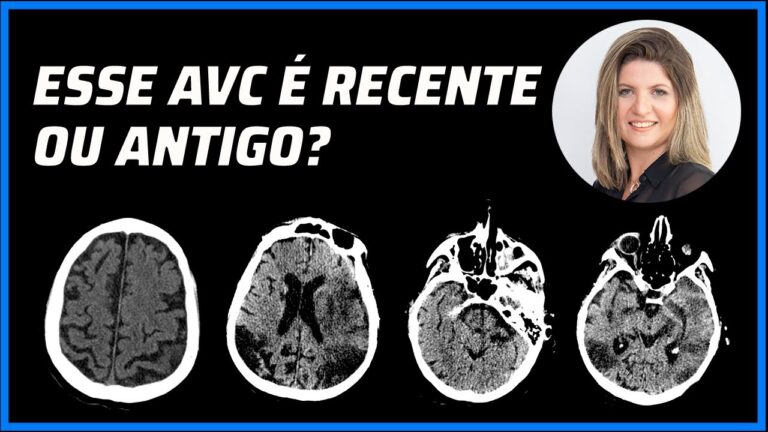 Progresso de um paciente pós-AVC
