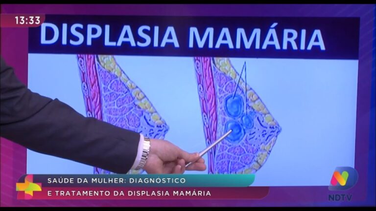 Entendendo a Mastopatia Fibrocística da Mama: Causas e Tratamentos