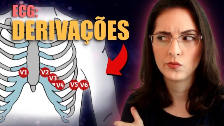 Interpreta&ccedil;&atilde;o das Deriva&ccedil;&otilde;es Precordiais no ECG