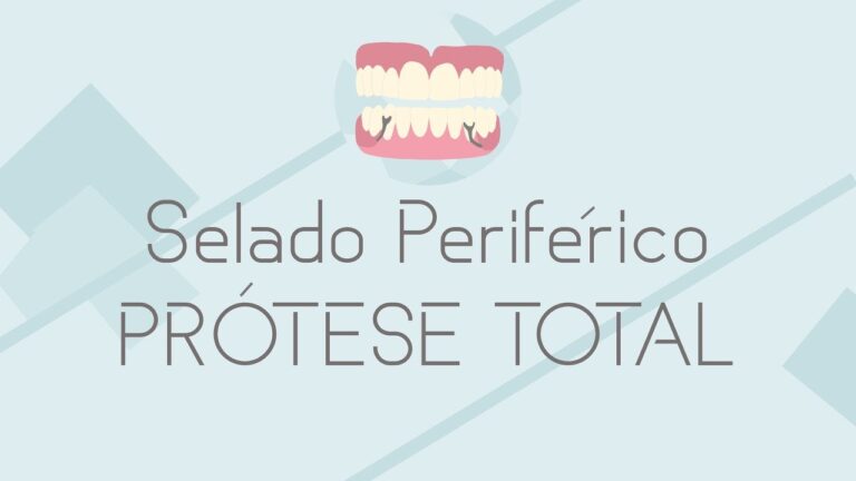 Selamento Periférico: Técnicas e Benefícios