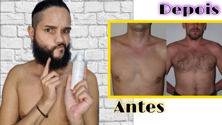 Minoxidil sem efeitos no peito: o que saber