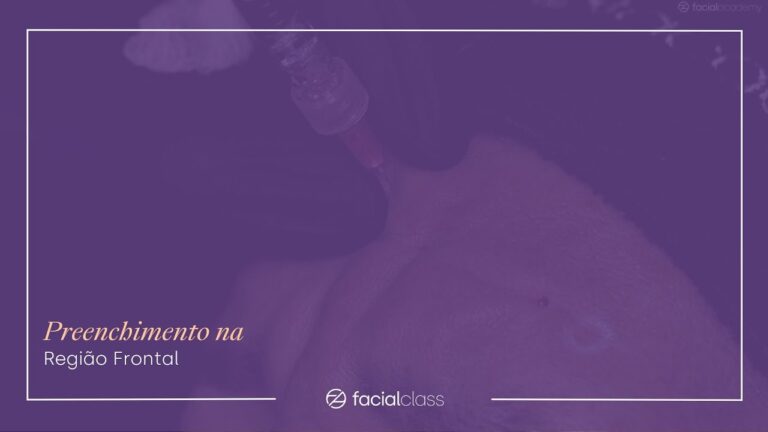 A Importância da Região Frontal da Face na Estética Facial