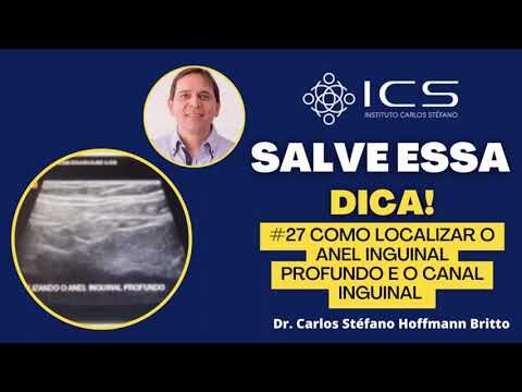 Entendendo o Anel Inguinal Profundo: Funções e Importância