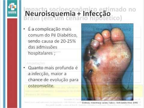 Riscos de Infecção em Pacientes Diabéticos: O que você precisa saber