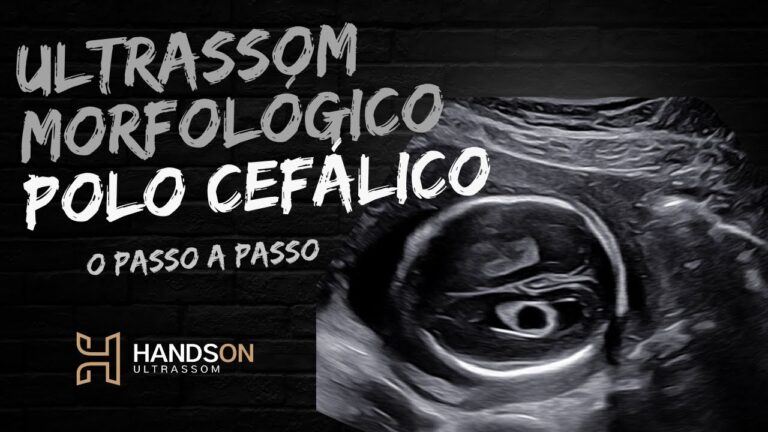 Entenda o Polo Cefálico: Função e Importância