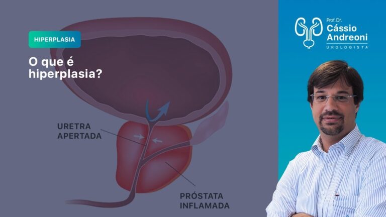 Hiperplasia Nodular da Próstata: Causas e Tratamentos