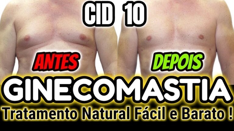 Entendendo a CID da Hipertrofia Mamária