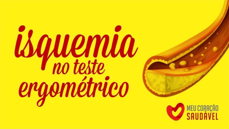 Teste Ergom&eacute;trico Positivo: Sinais de Isquemia